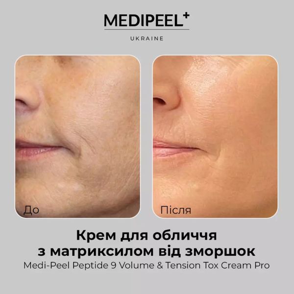 Антивіковий ліфтинг-крем з пептидами MEDI-PEEL Peptide 9 Volume and Tension PRO Tox Cream 50 MP1039 фото