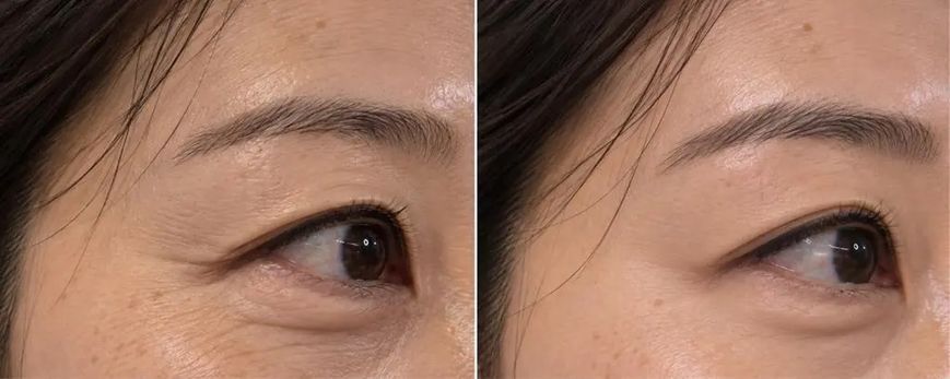 Крем для пружності шкіри навколо очей з LED EMS-аплікатором UIQ RejuBiome&trade; EX Lifting Eye Cream, 15 мл UIQ1012 фото