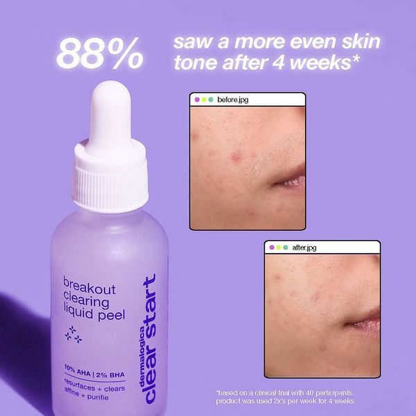 Очищуючий пілінг Dermalogica ClearStart Breakout Liquid Peel DE1004 фото