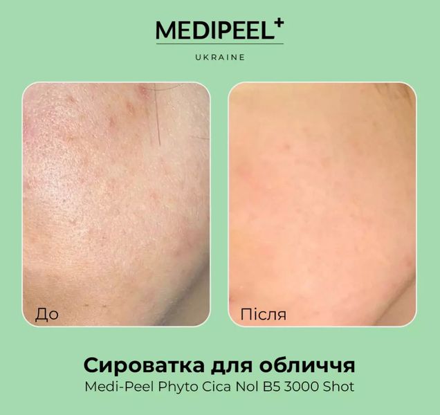 Сироватка-пілінг для проблемної шкіри Medi-Peel Phyto Cica-Nol B5 3000 Shot Serum 50 ml MP1047 фото