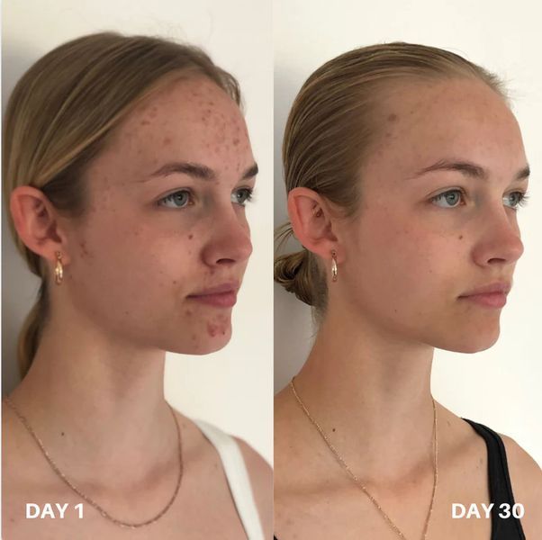 Очищувач для шкіри Clinisoothe+ Skin Purifier, 250 мл CL1002 фото