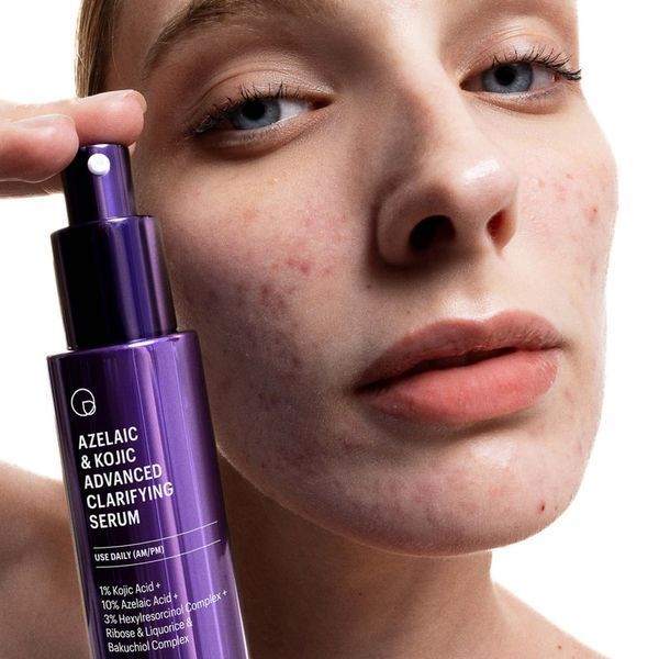 Освітлюючий серум Allies of Skin Azelaic & Kojic Advanced Clarifying Serum AOS1004 фото