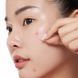 Патчі з мигдальною кислотою від висипань та постакне BY WISHTREND Mandelic Acid Spot Clearing Patch 39 шт BW1023 фото 5