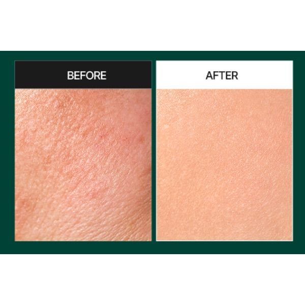 Сироватка-пілінг для проблемної шкіри Medi-Peel Phyto Cica-nol B5 6,000 Shot Serum, 50ml MP1058 фото